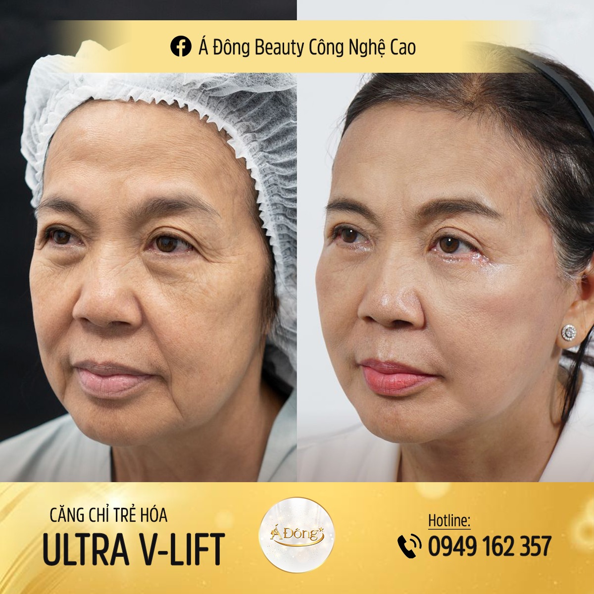 Thẩm Mỹ Viện Á ĐÔNG ảnh 1