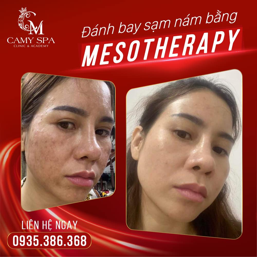 Thẩm Mỹ Viện CAMY Clinic ảnh 3