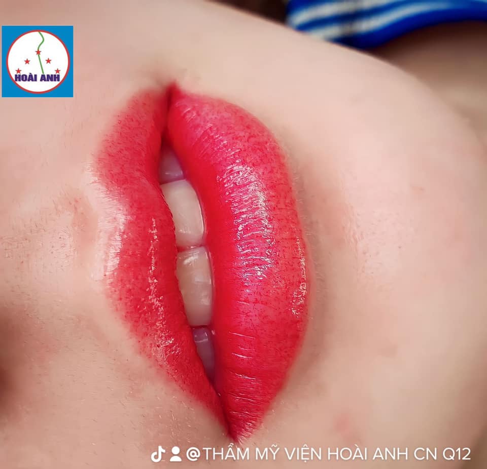 Thẩm Mỹ Viện Hoài Anh ảnh 1