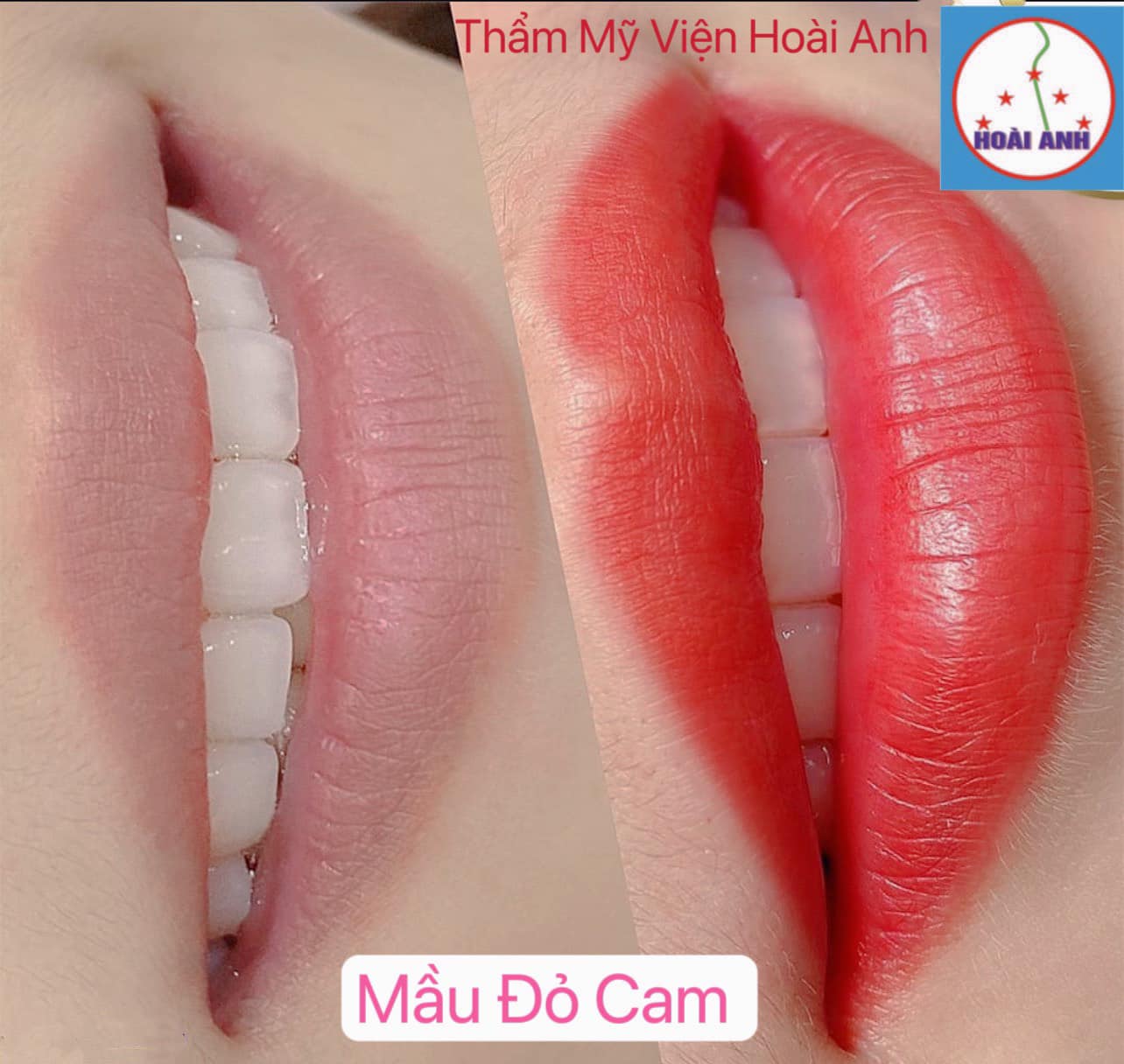 Thẩm Mỹ Viện Hoài Anh ảnh 3