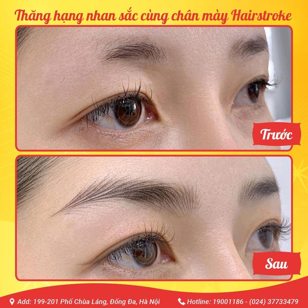 Thẩm mỹ viện Hoài Anh ảnh 2