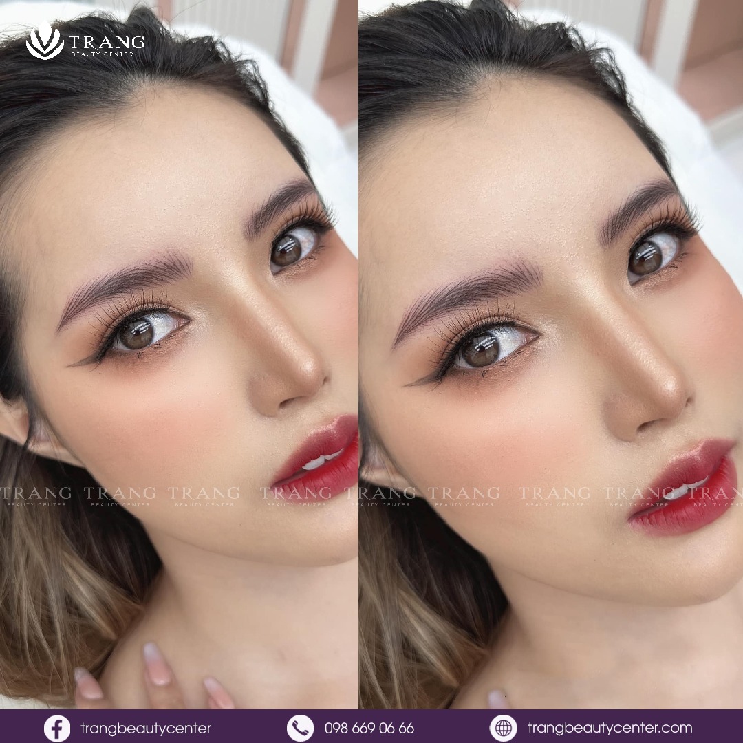 Trang Beauty Center ảnh 2