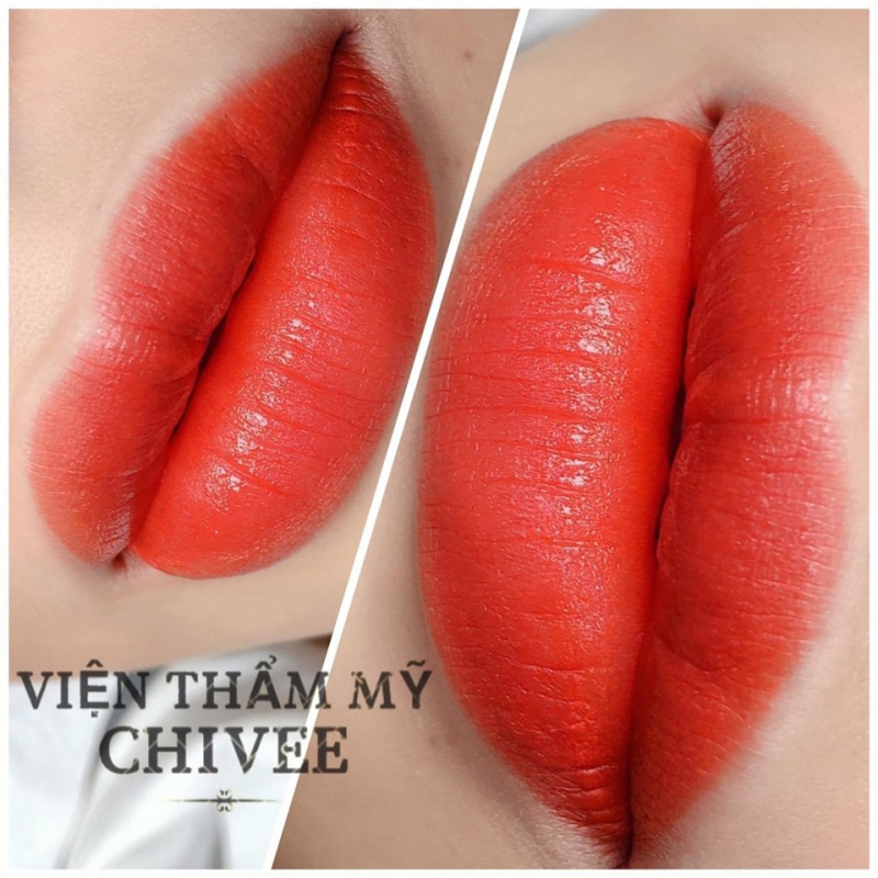 Viện Thẩm Mỹ ChiVee ảnh 1