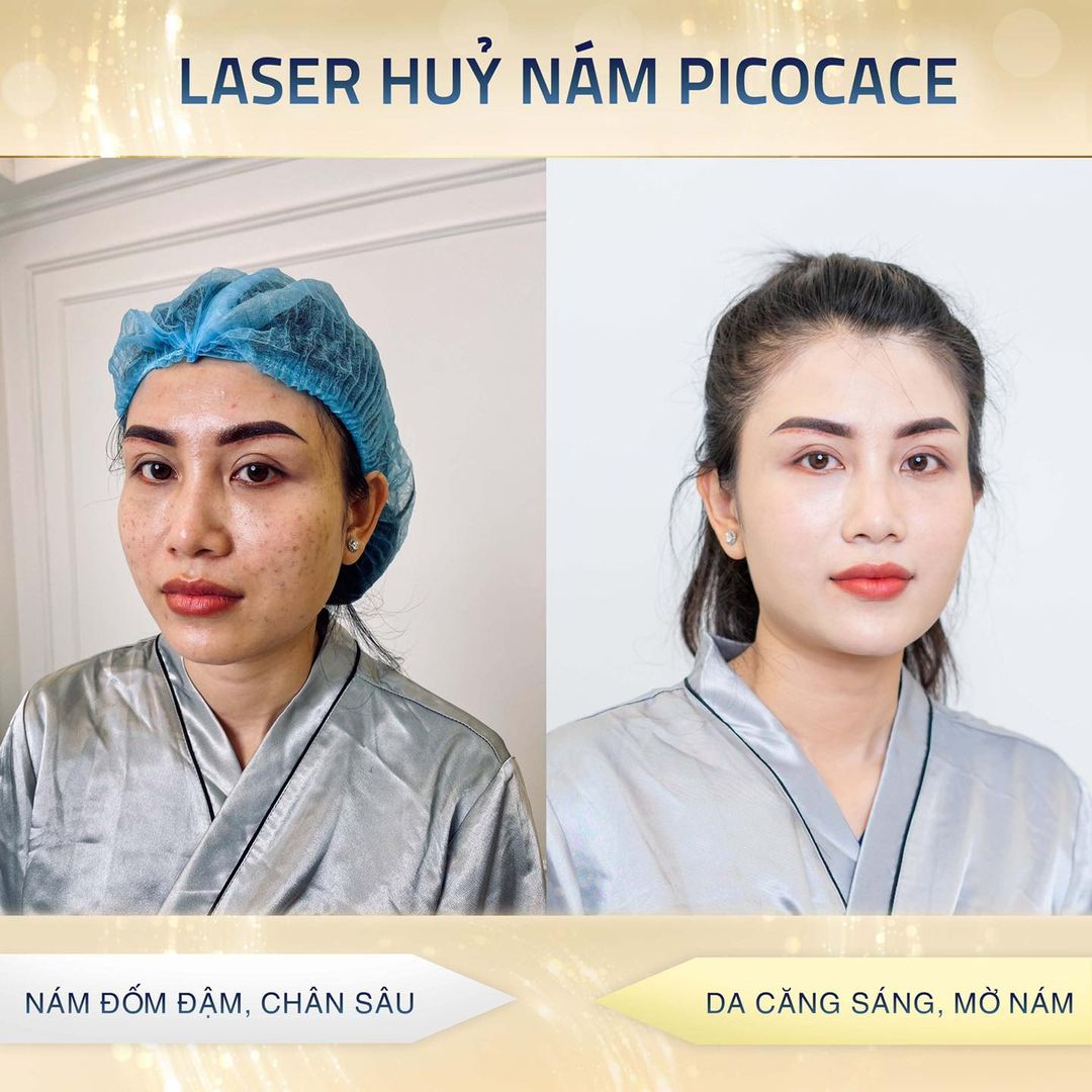 Viện Thẩm Mỹ Quốc Tế Mộc Trà ảnh 2