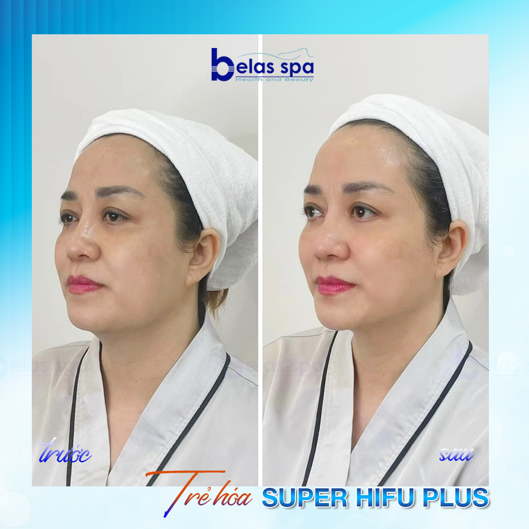 Belas Health & Beauty ảnh 2