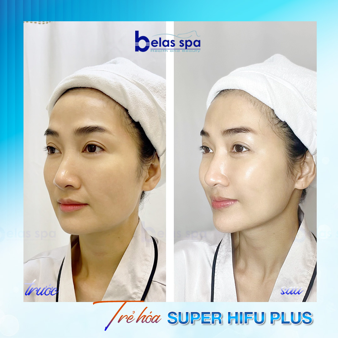 Belas Health & Beauty ảnh 1