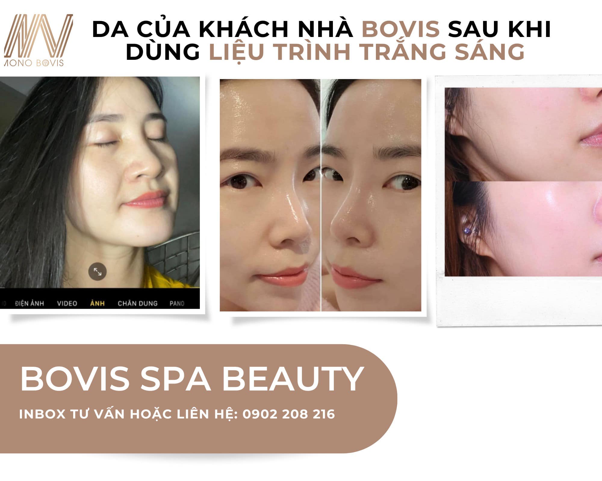 Bovis Spa and Academy ảnh 1