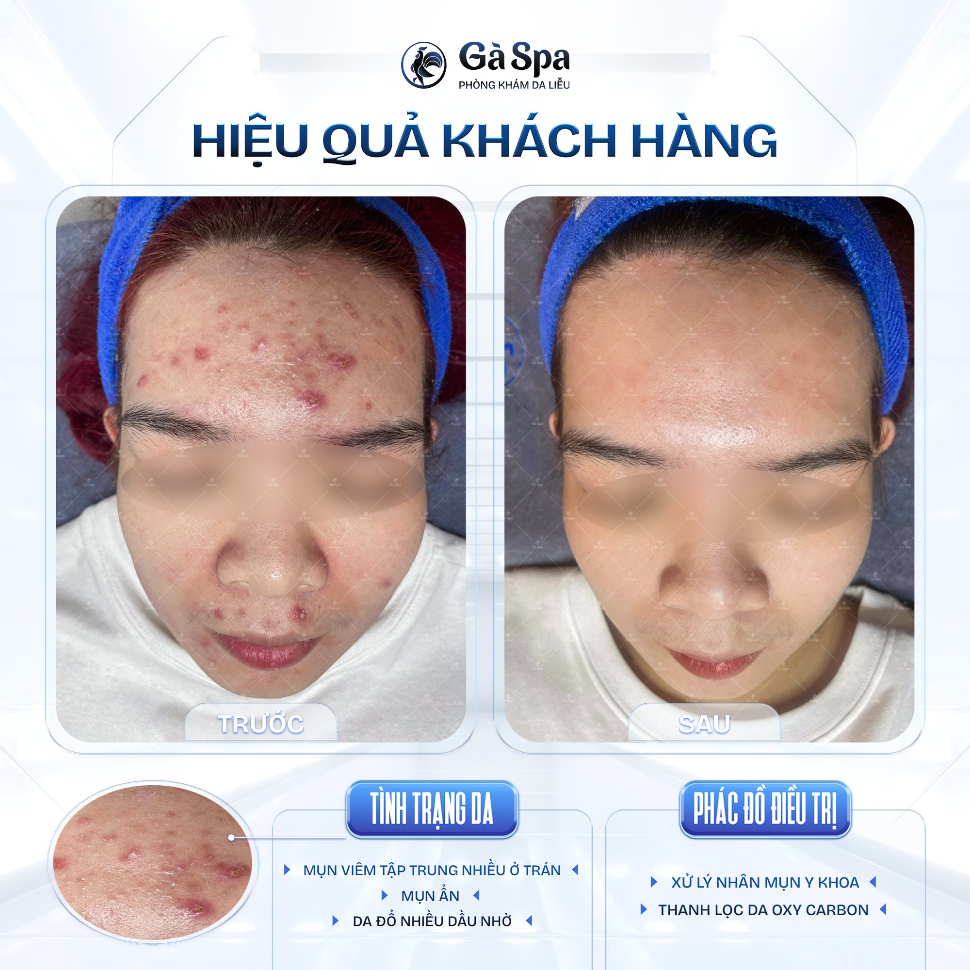 Gà Spa ảnh 1