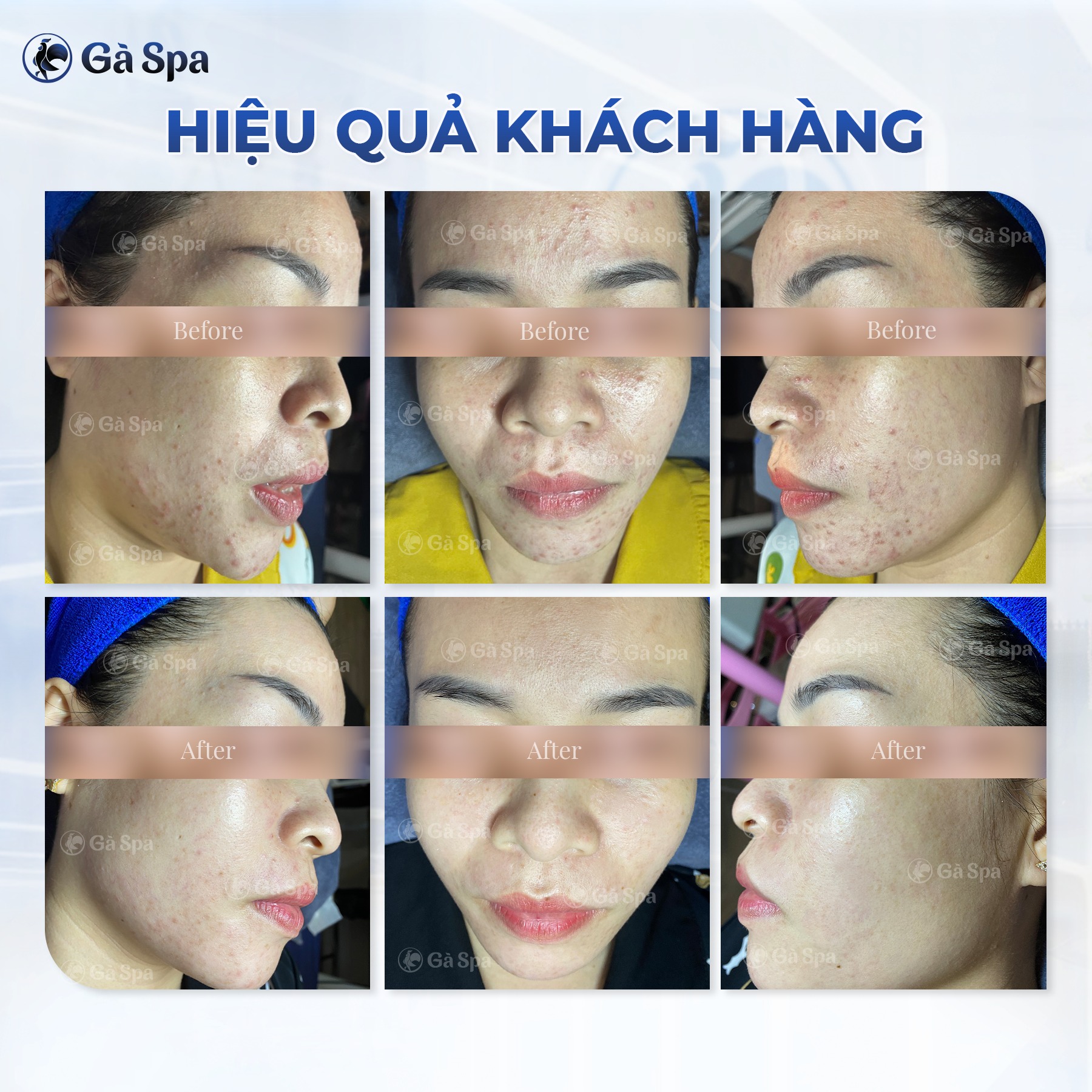 Gà Spa ảnh 1