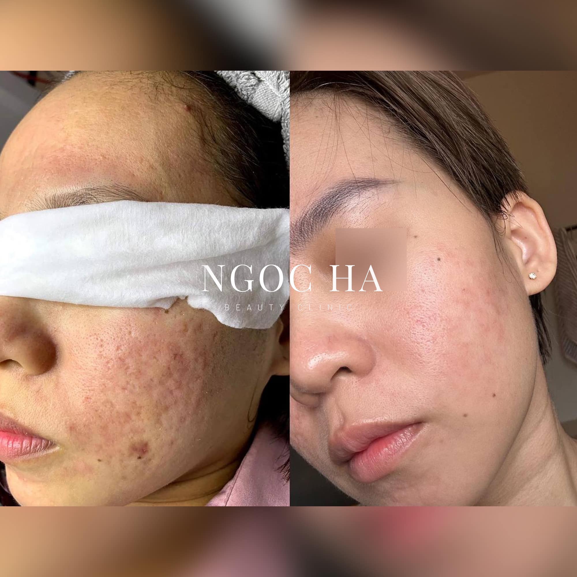 Ngọc Hà Beauty Clinic ảnh 2