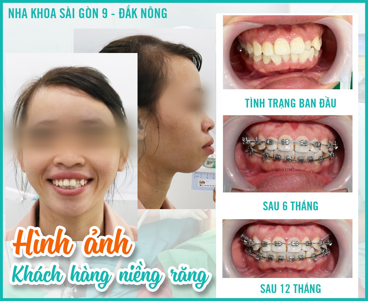 Nha Khoa Daknong - Nha Khoa Sài Gòn 9 ảnh 2