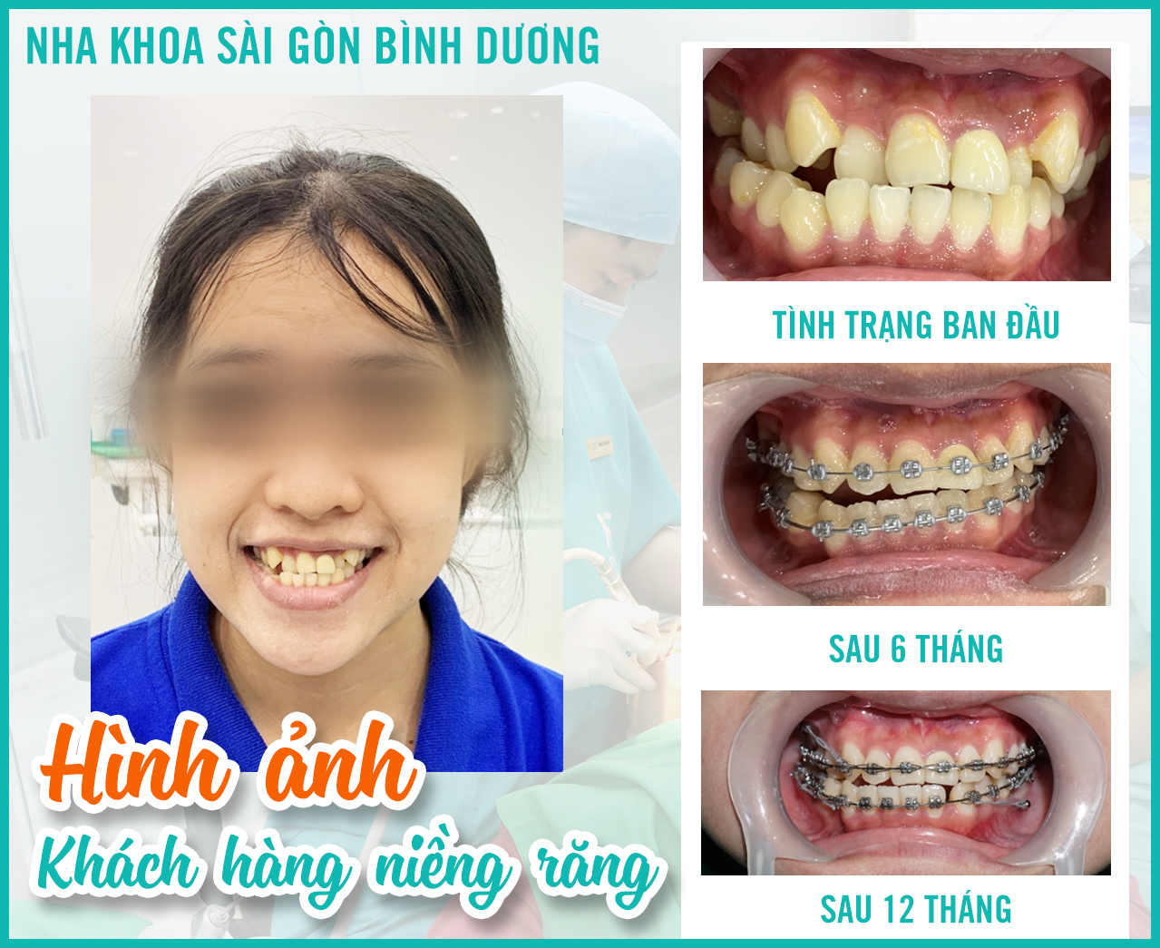 Nha Khoa Daknong - Nha Khoa Sài Gòn 9 ảnh 1