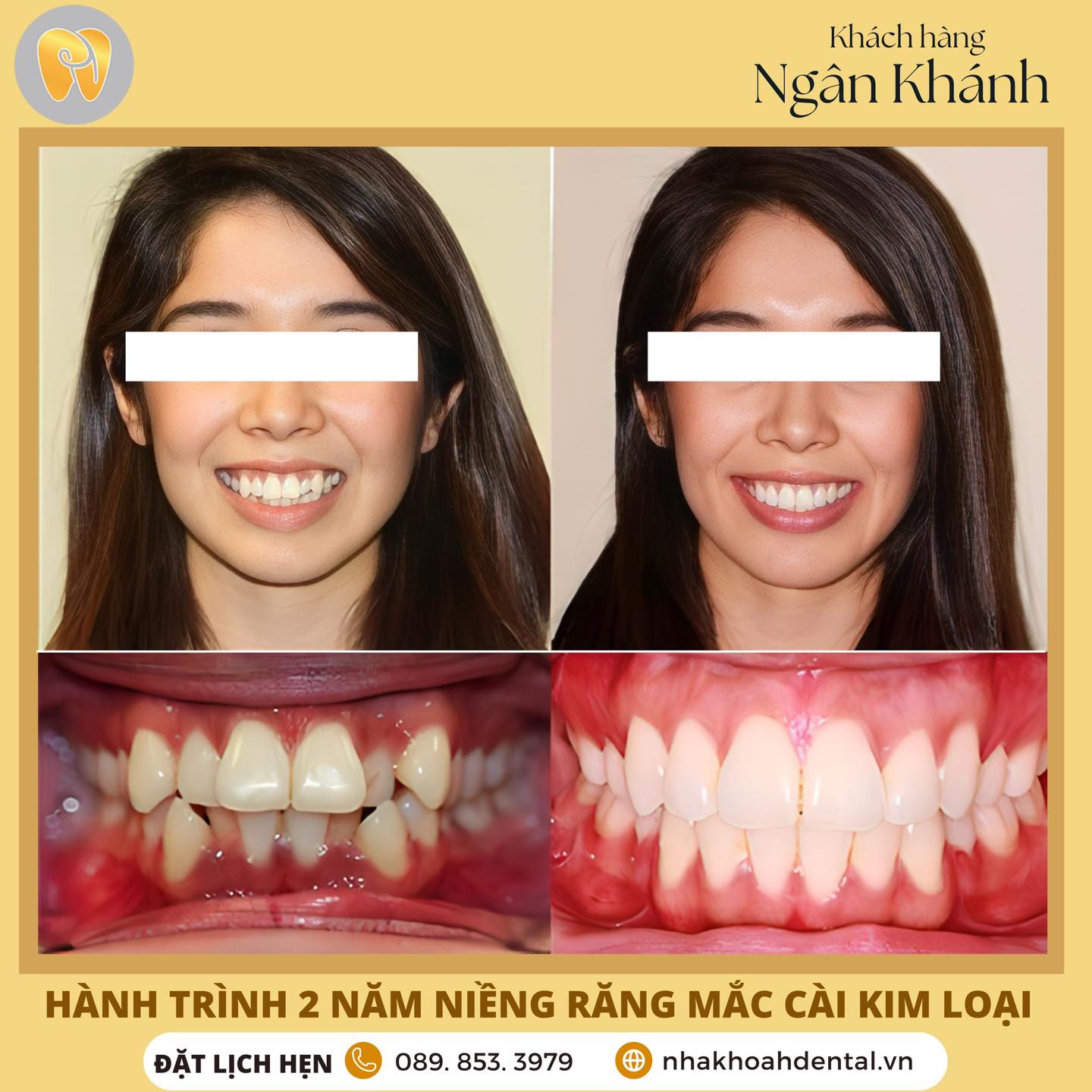 Nha Khoa H Dental ảnh 2