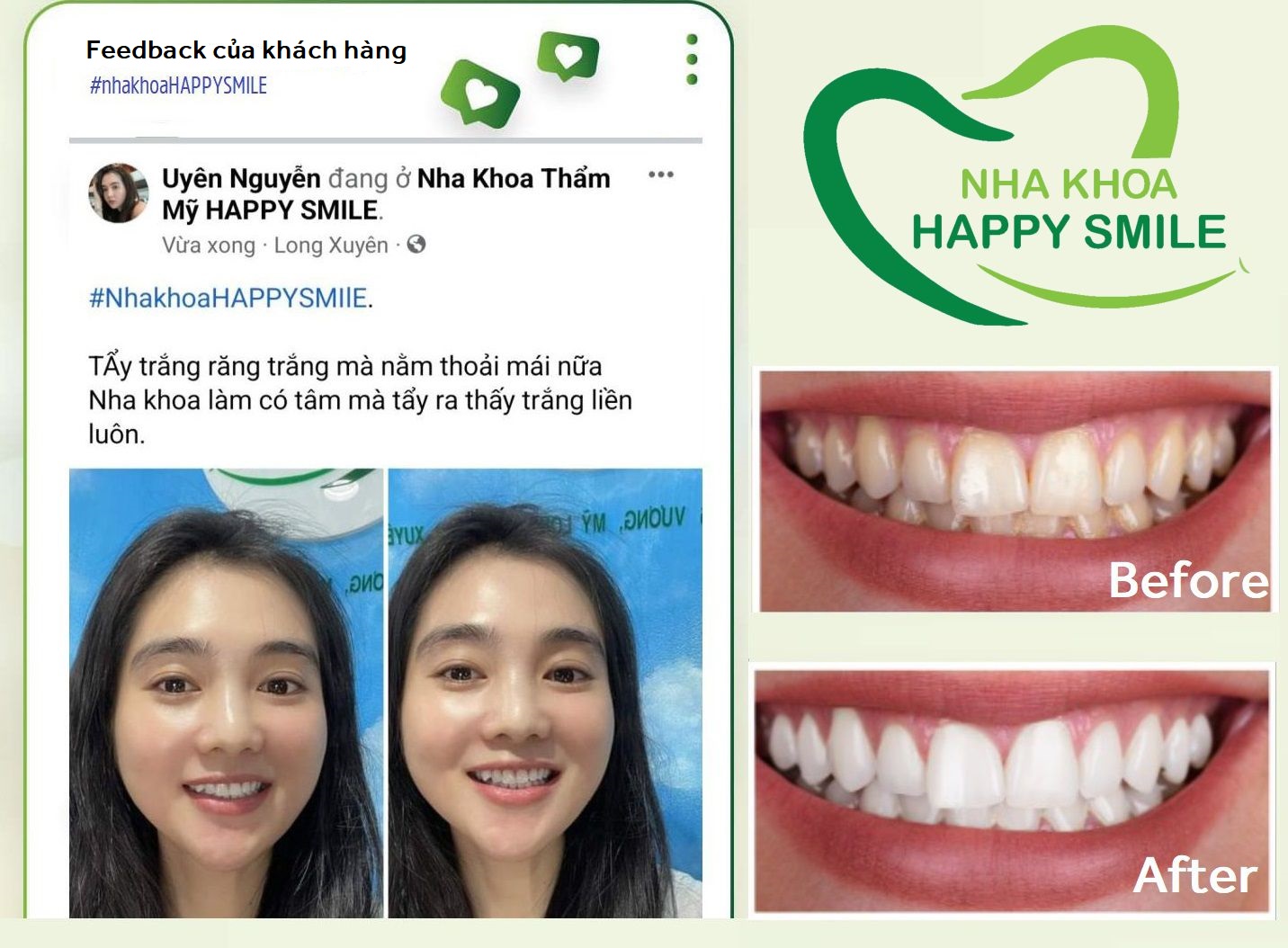 Nha Khoa Happy Smile ảnh 2