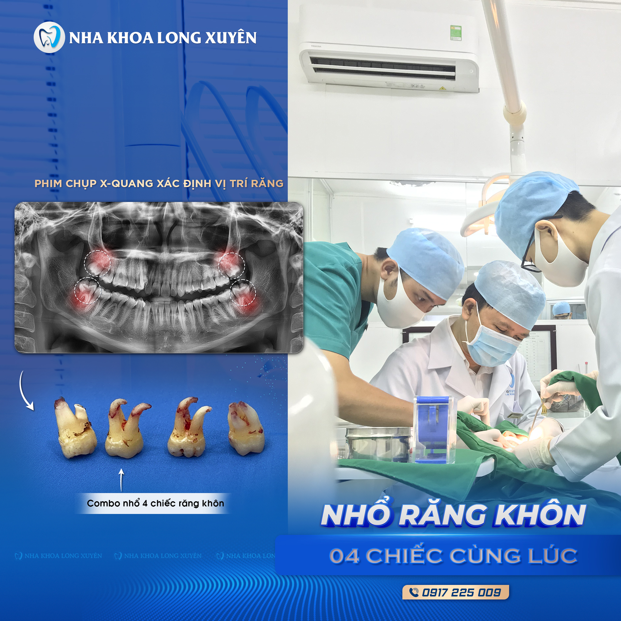 Hệ Thống Nha Khoa Long Xuyên ảnh 1