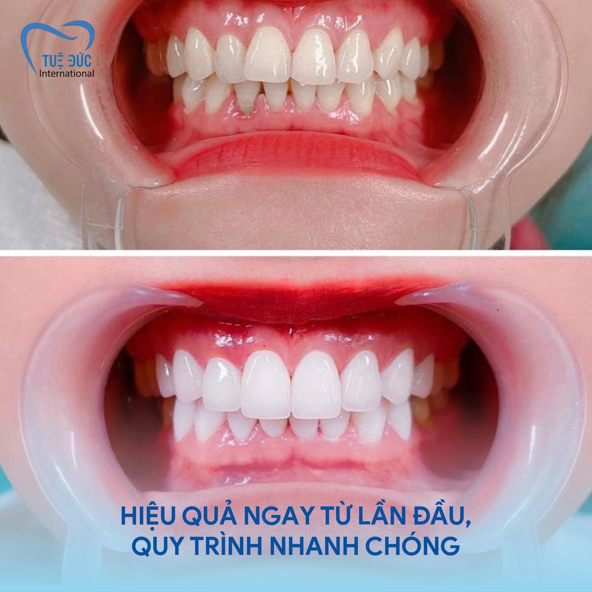 Nha Khoa Quốc Tế Tuệ Đức ảnh 2