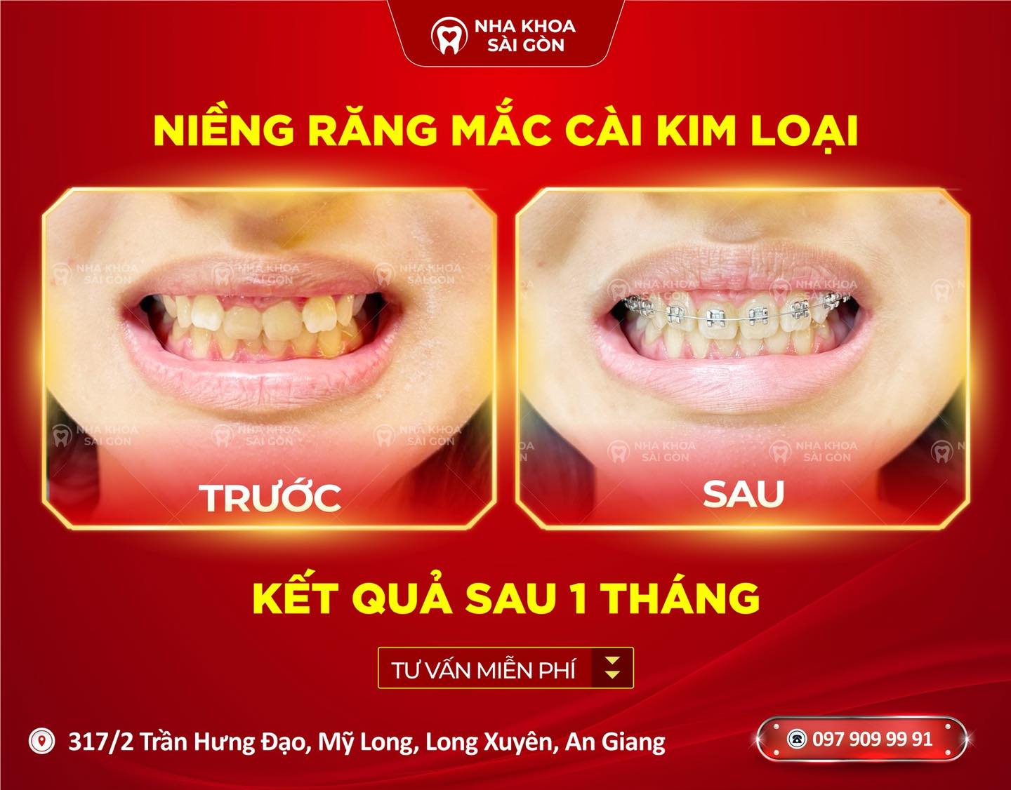 Nha Khoa Sài Gòn ảnh 2