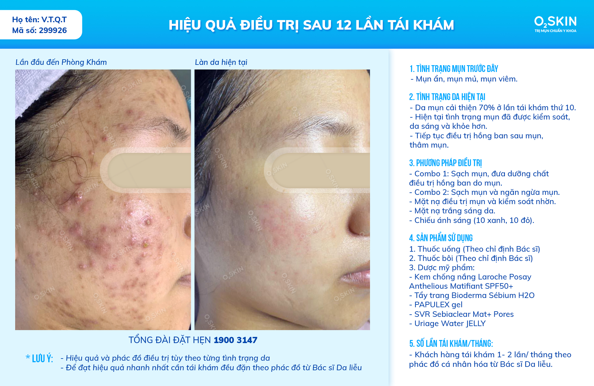 Phòng Khám Chuyên Khoa Da Liễu O2 SKIN ảnh 2