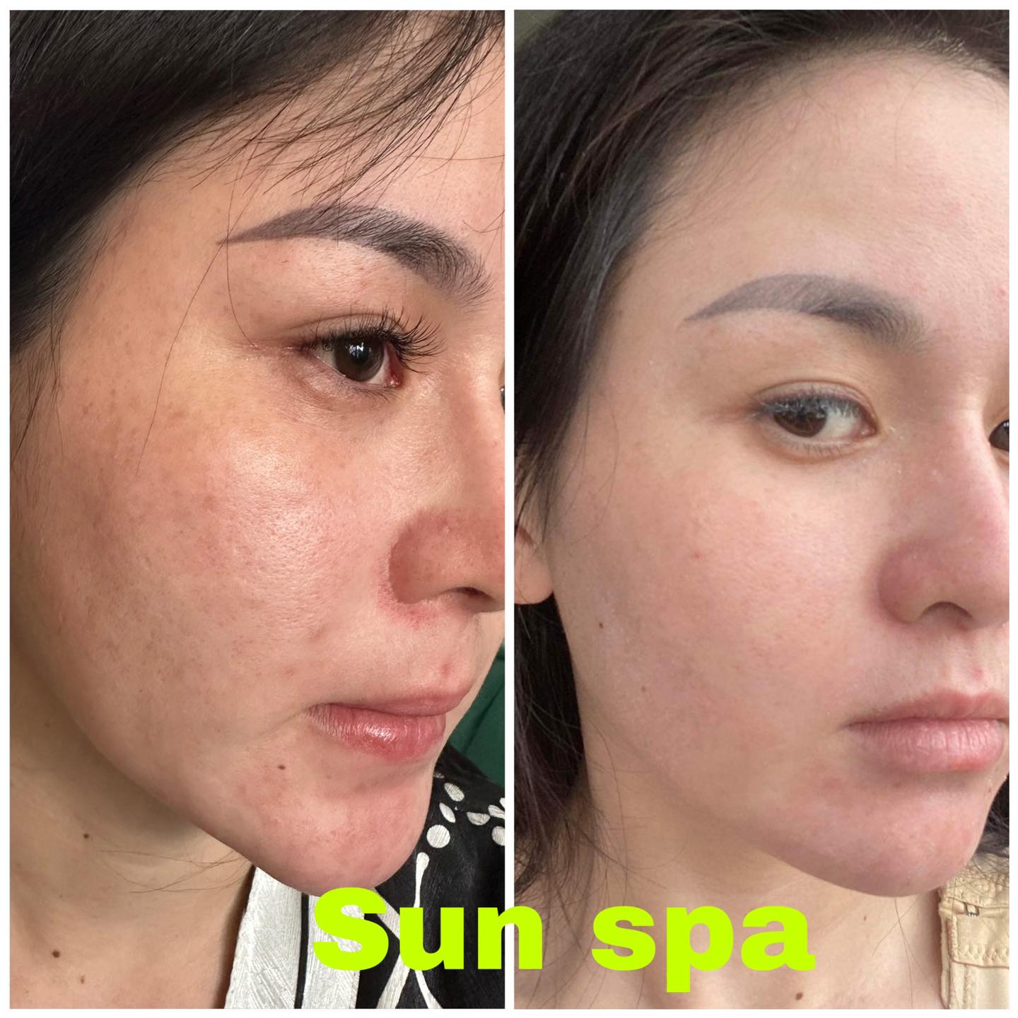 Sun Spa ảnh 2