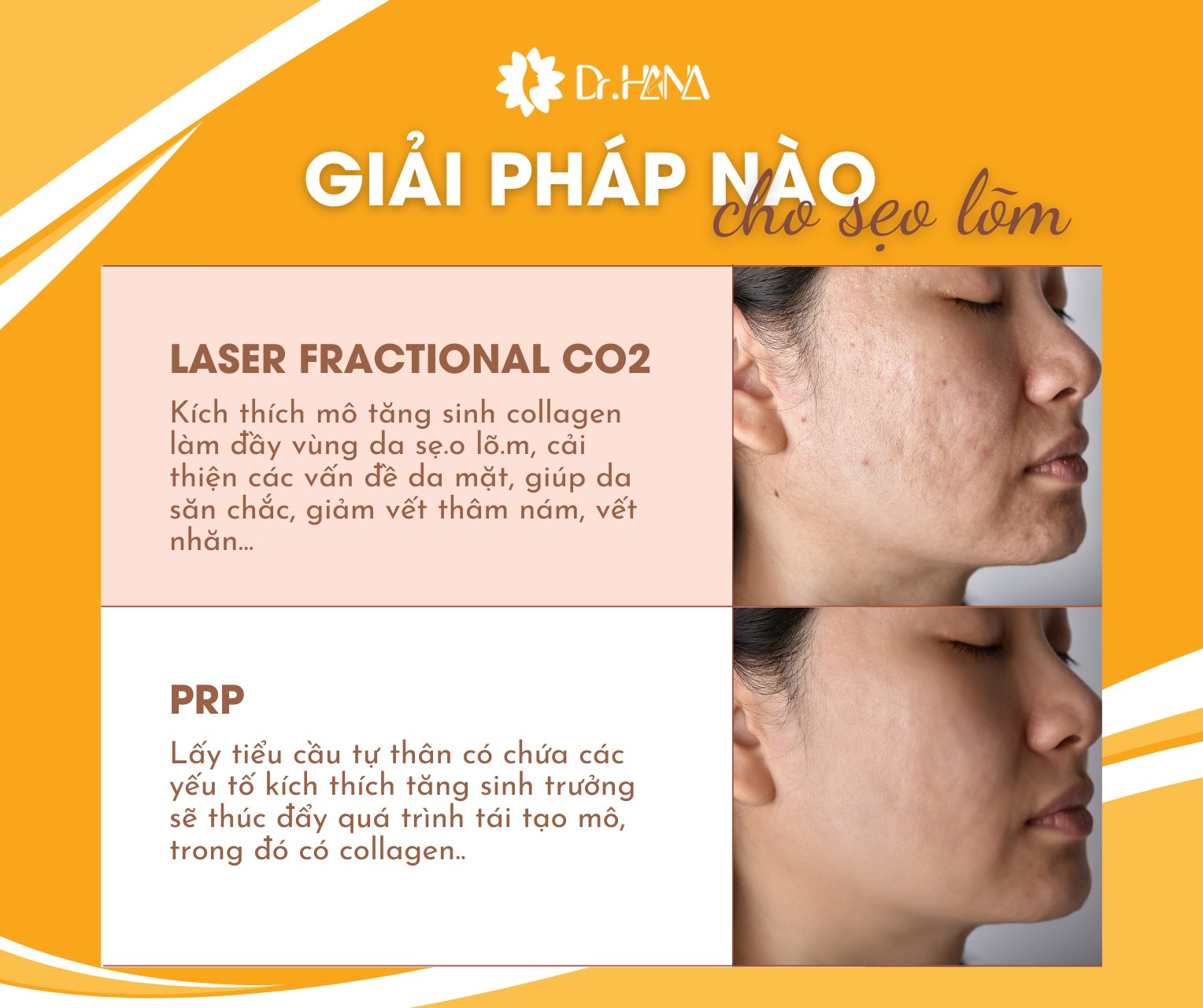 Viện Thẩm Mỹ Dr.Hana ảnh 1