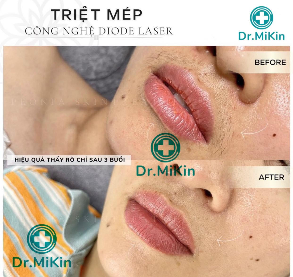 Viện thẩm Mỹ Dr. Mikin ảnh 1