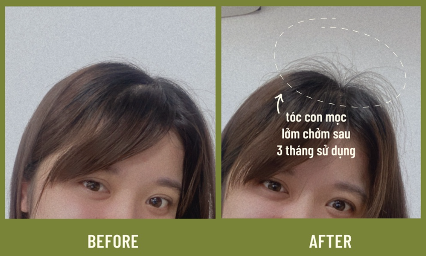 Hair Serum Tóc Mây ảnh 1