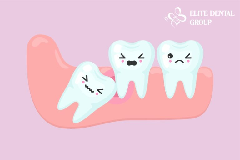 Nha khoa Elite Dental ảnh 2