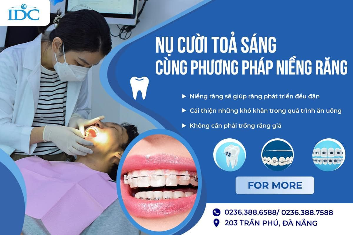 Nha khoa IDC Da Nang ảnh 2