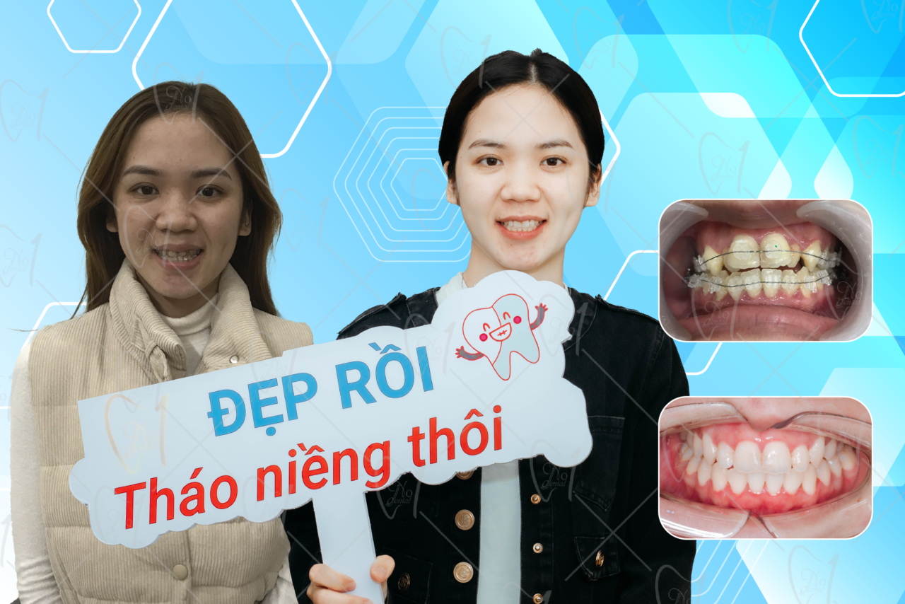 Nha khoa No1 Đà Nẵng ảnh 1