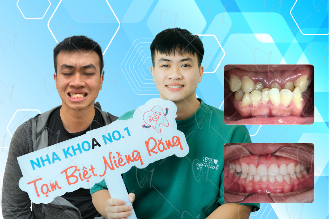 Nha khoa No1 Đà Nẵng ảnh 2