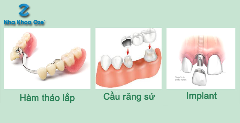 Nha khoa OZE ảnh 1