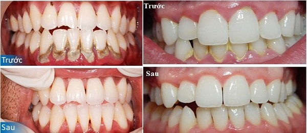 Nha khoa Peace Dentistry ảnh 1