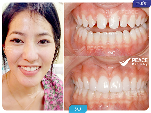 Nha khoa Peace Dentistry ảnh 2