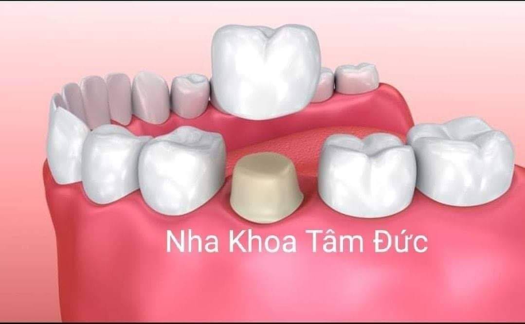 Nha khoa Tâm Đức ảnh 2