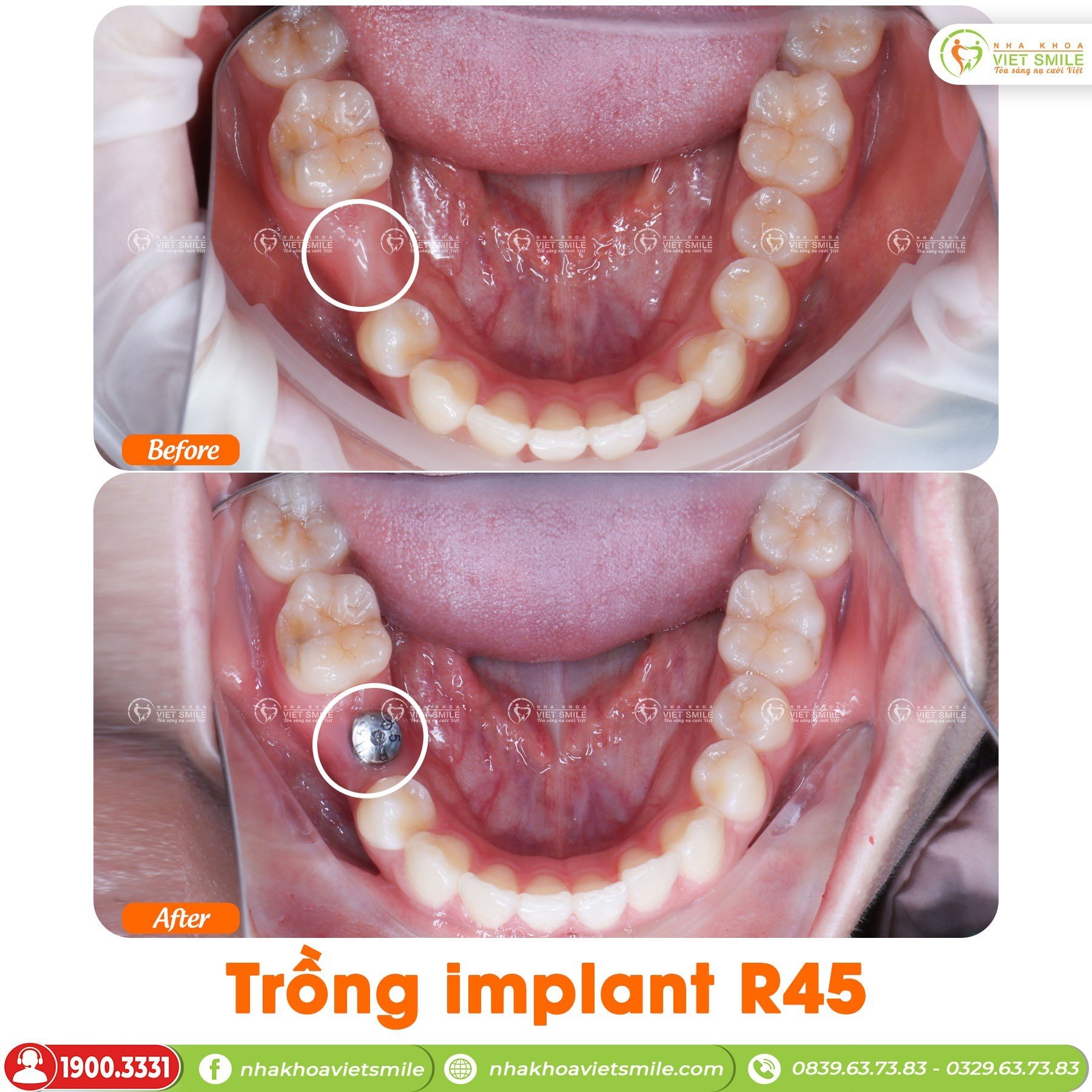 Nha khoa Việt Smile ảnh 1