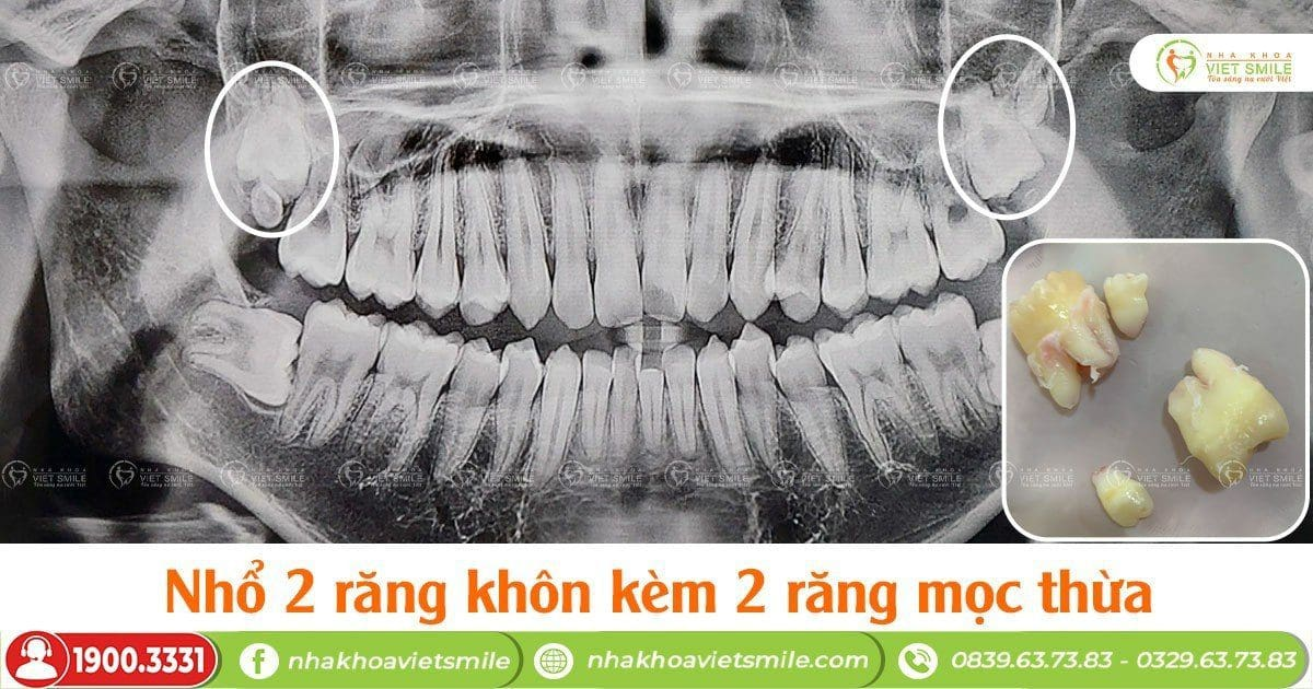 Nha khoa Việt Smile ảnh 1