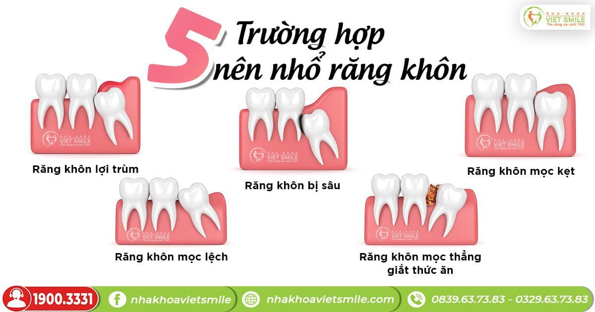 Nha khoa Việt Smile ảnh 2