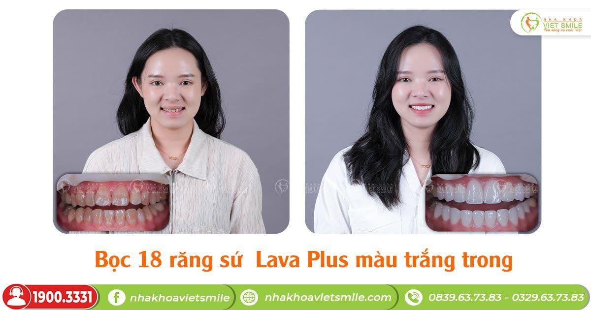 Nha khoa Việt Smile ảnh 1