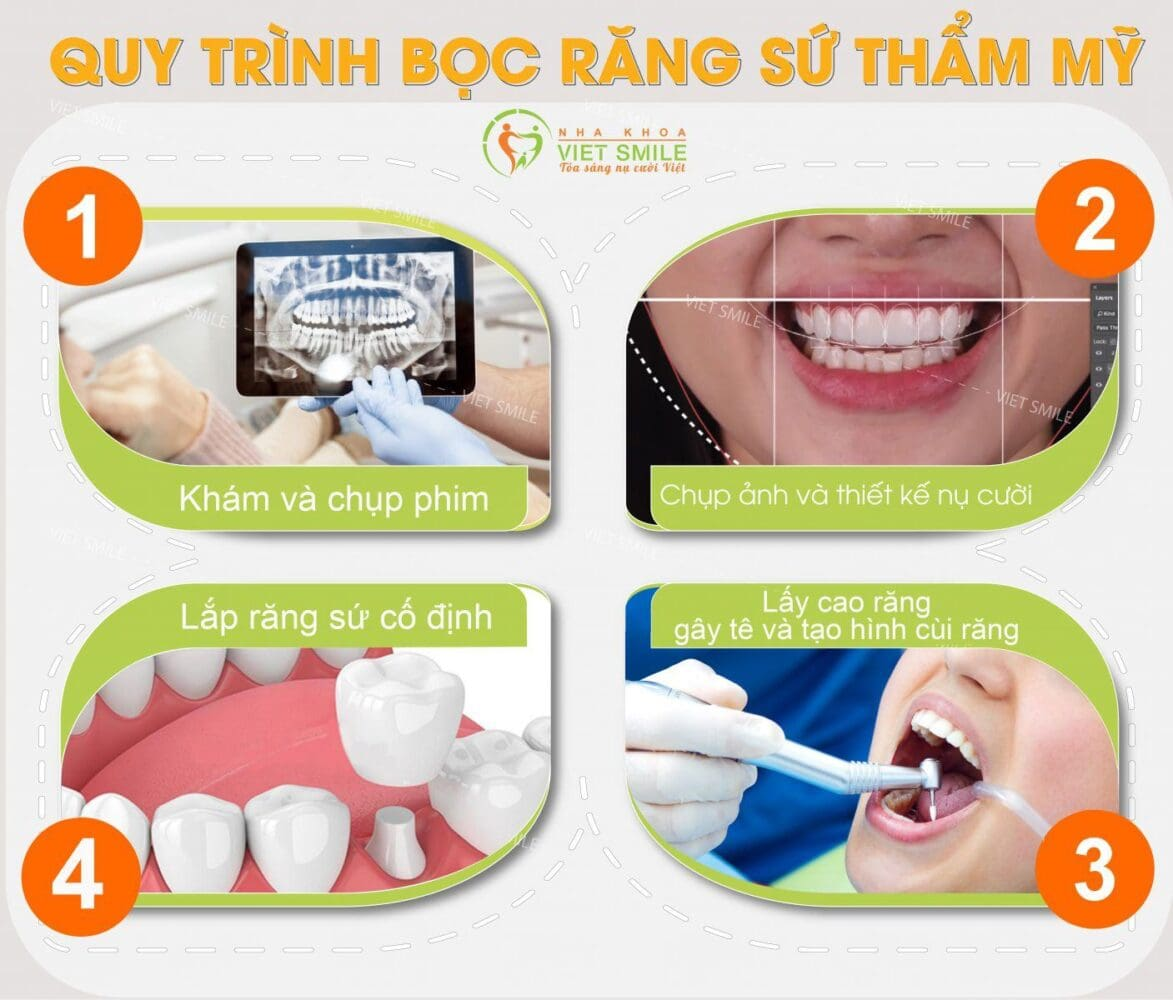 Nha khoa Việt Smile ảnh 2