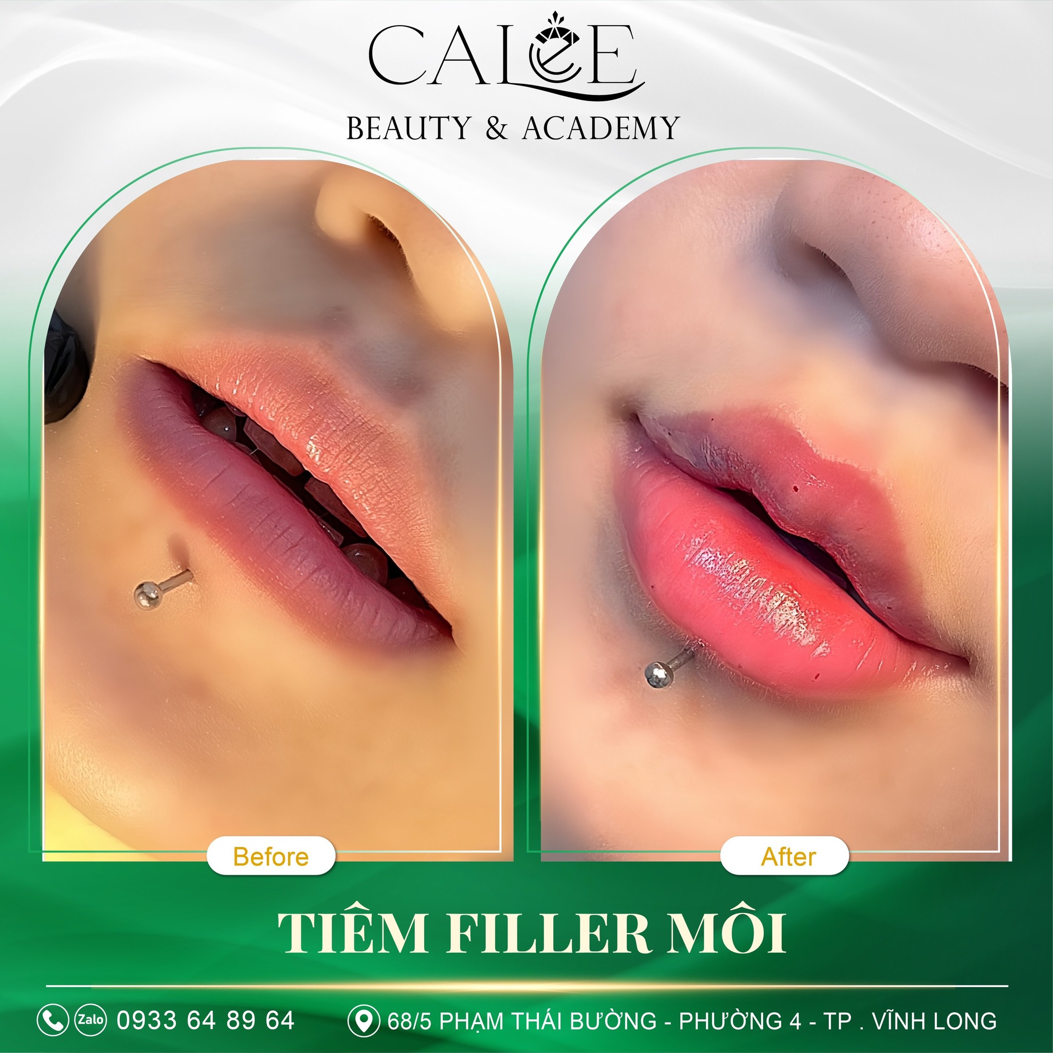 CaLee Beauty ảnh 2