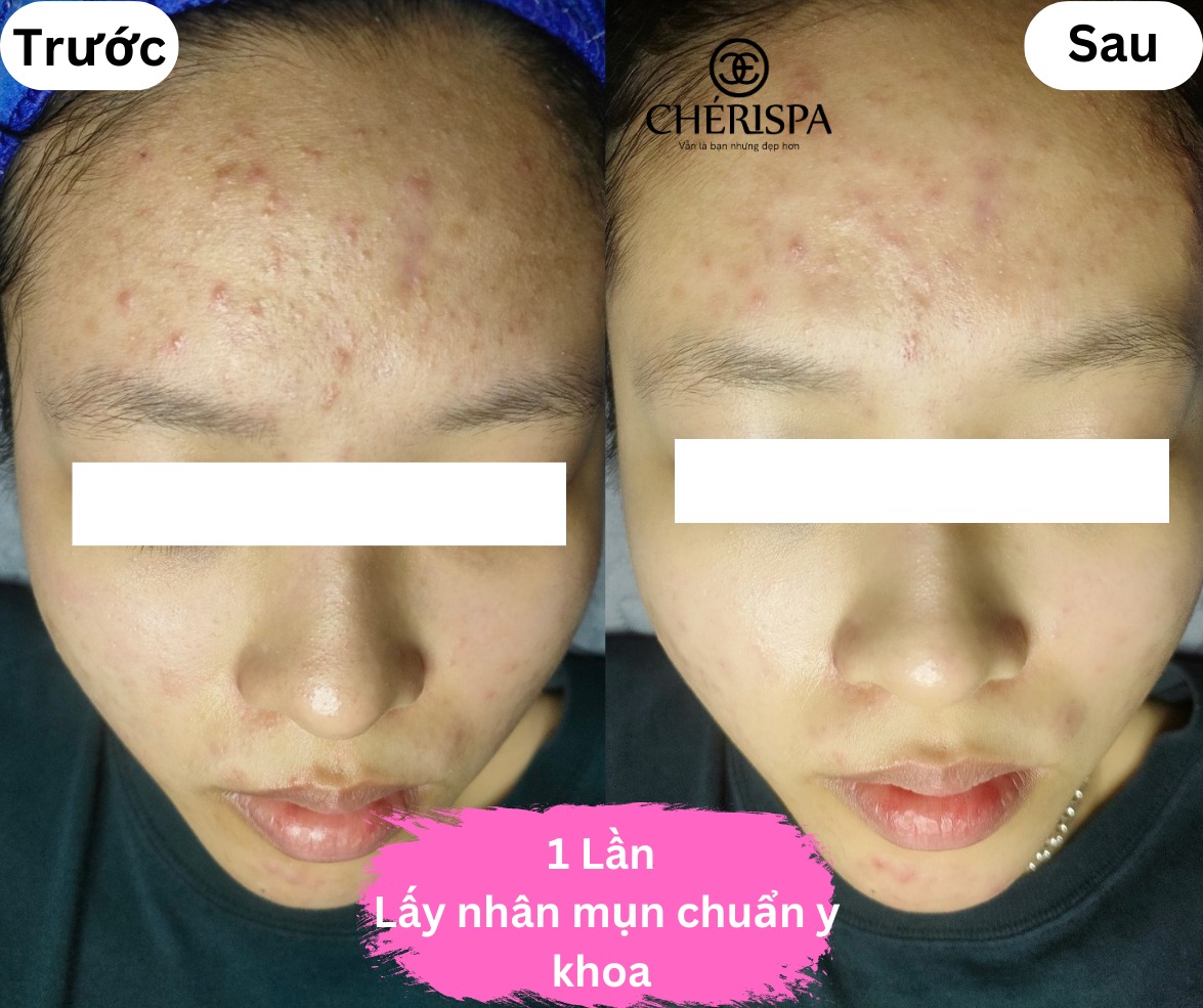 Chérispa Quảng Ngãi ảnh 1