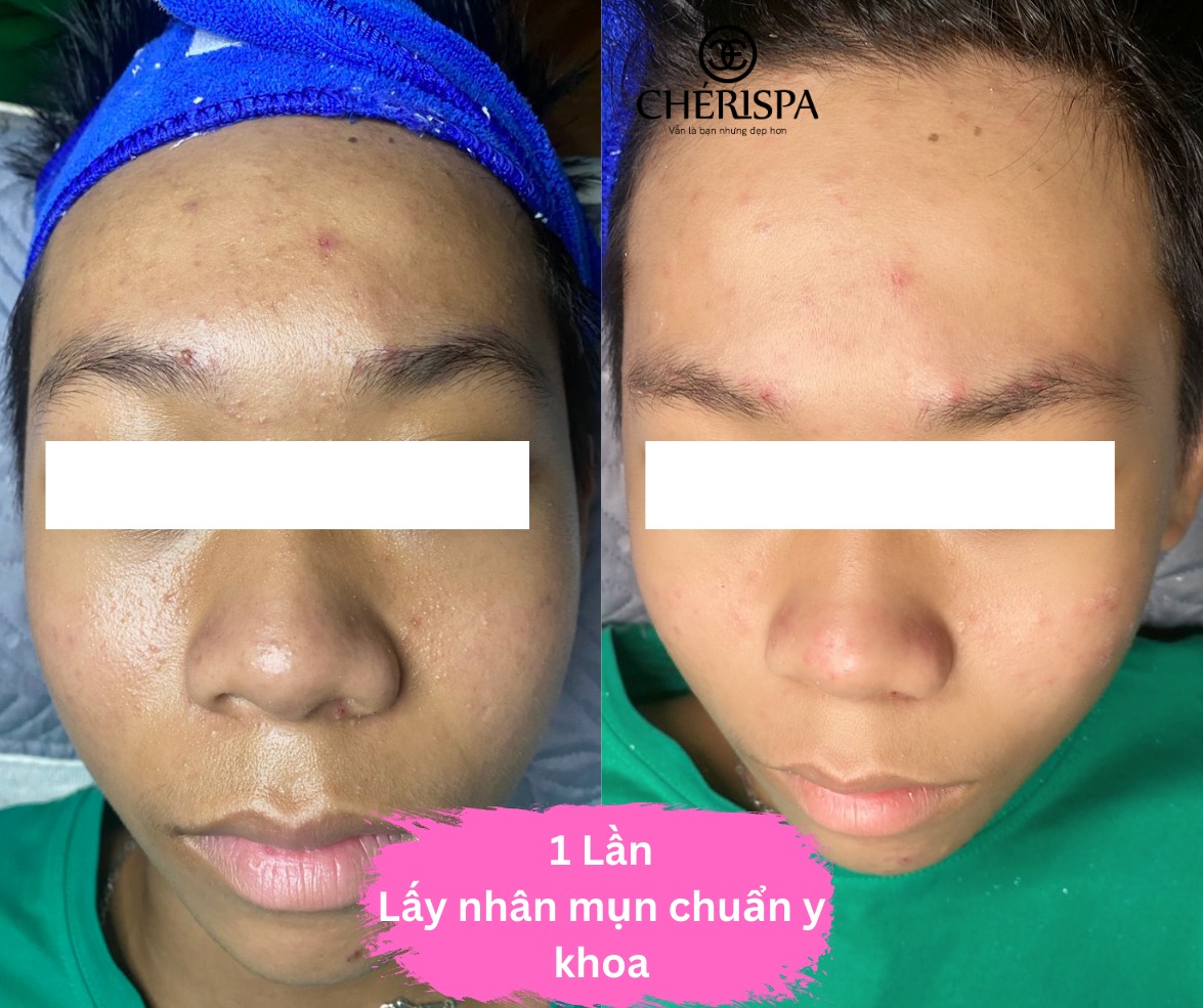 Chérispa Quảng Ngãi ảnh 2