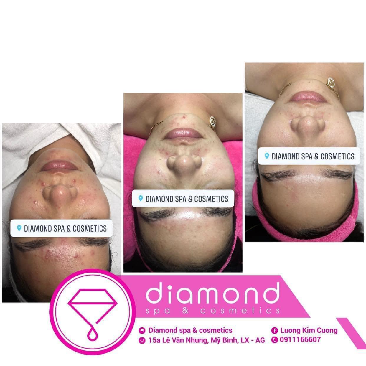 Diamond Spa & Cosmetics ảnh 2