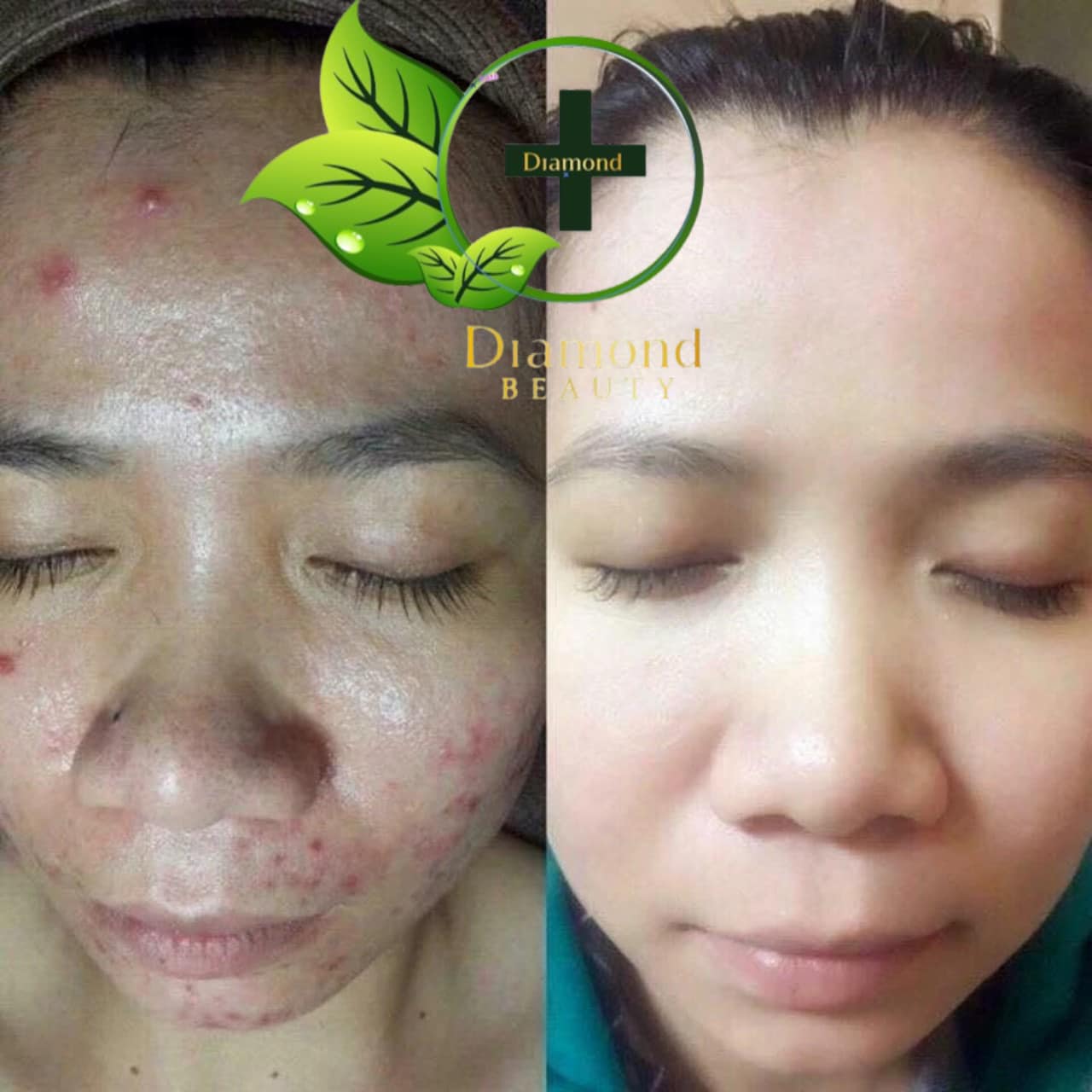 Diamond spa & Beauty ảnh 1