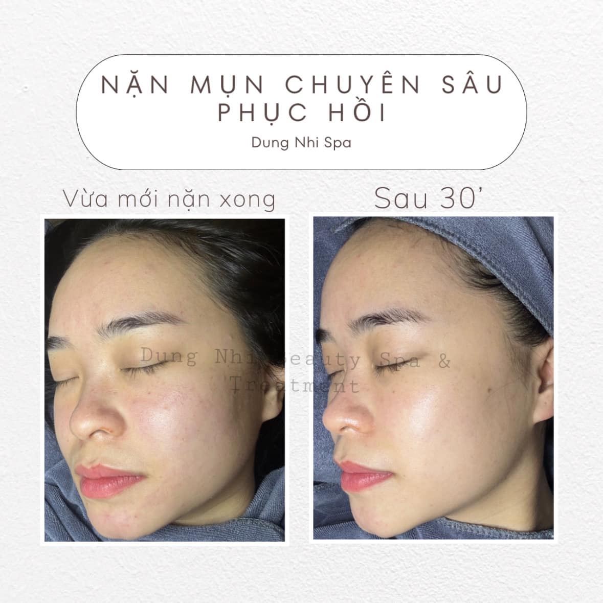 Dung Nhi Beauty Spa ảnh 2