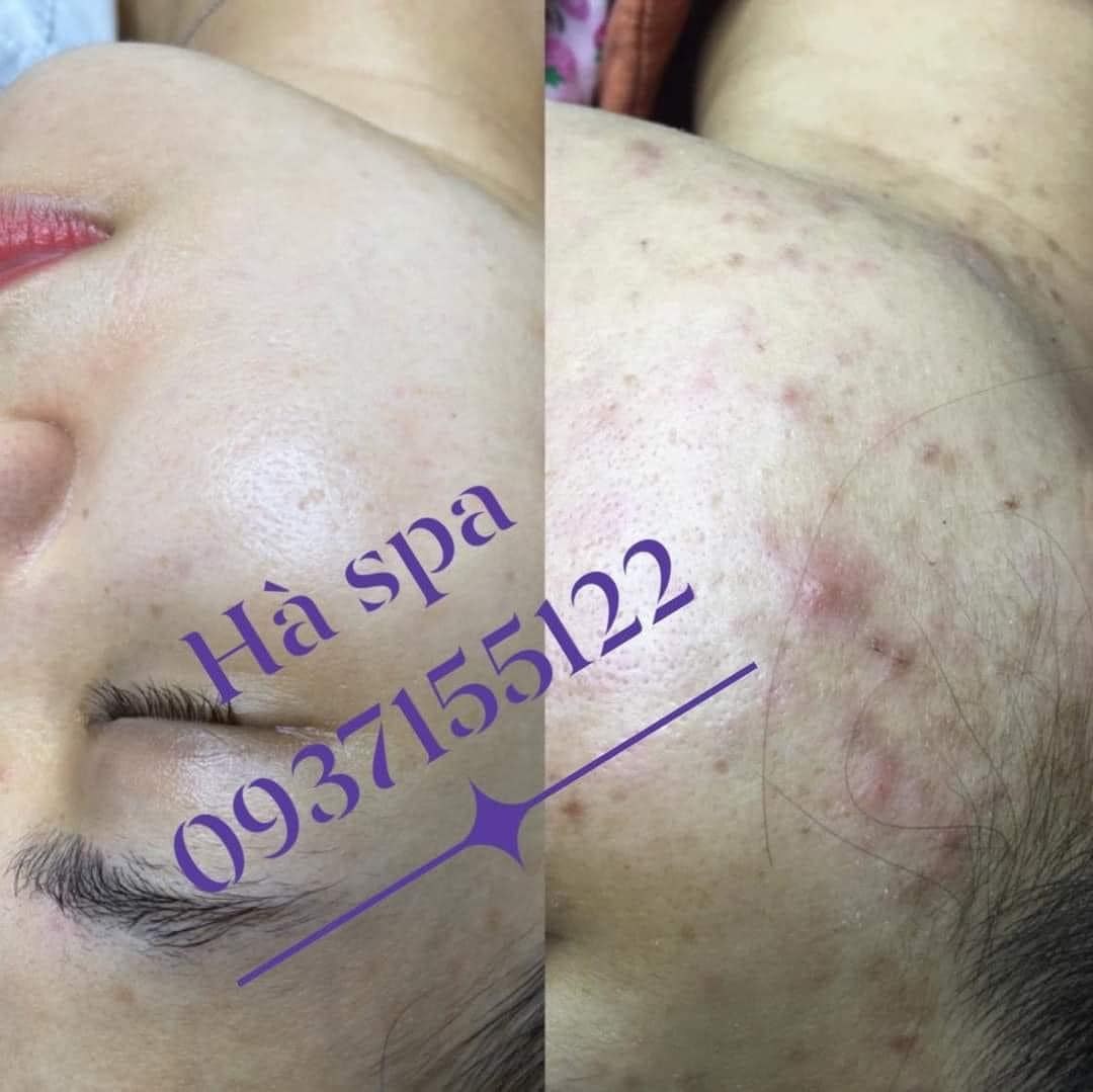 Hà Spa ảnh 2