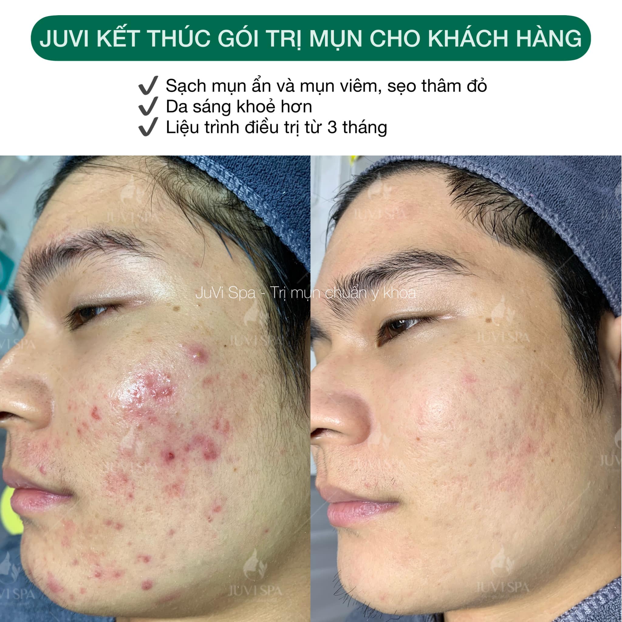 JUVI SPA ảnh 1