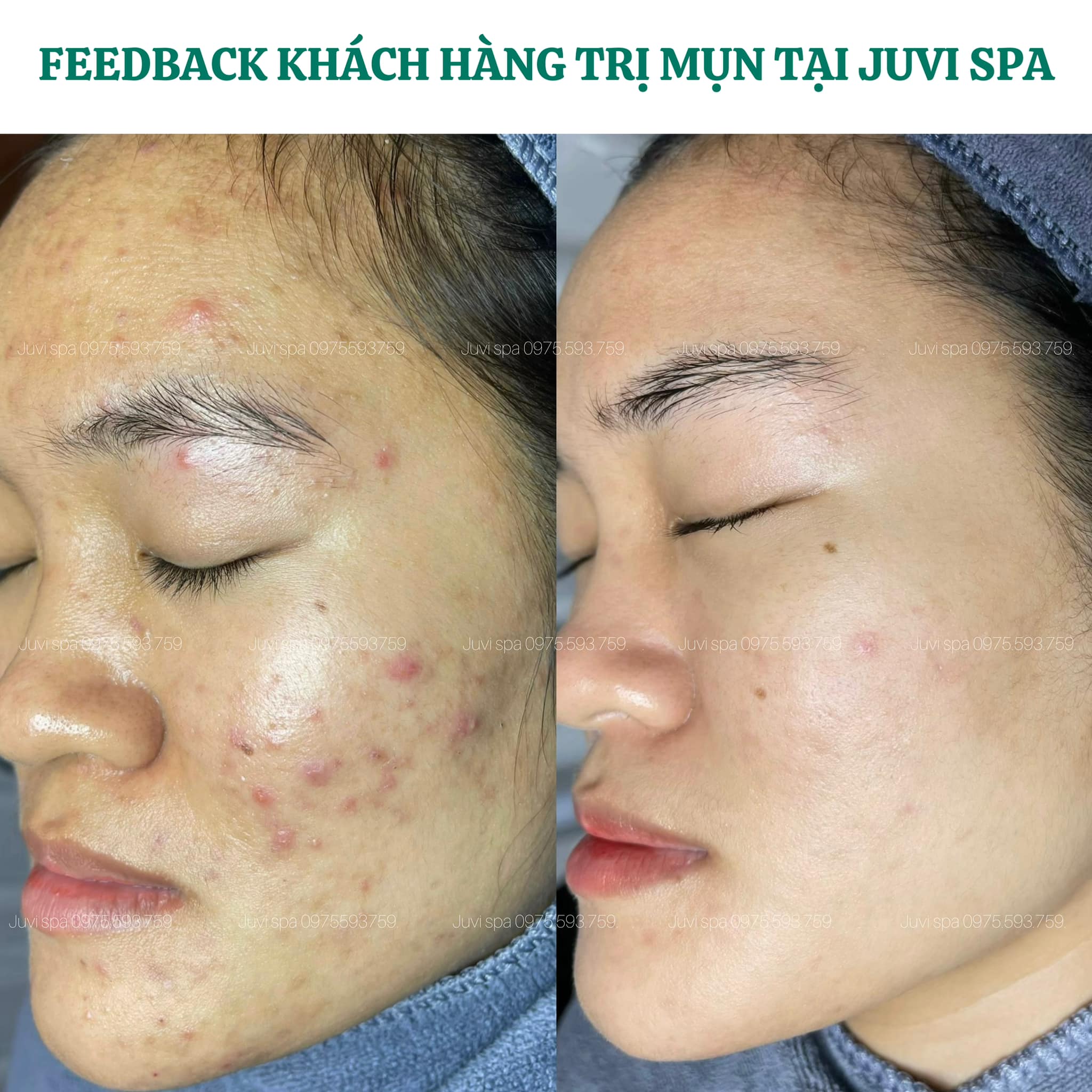 JUVI SPA ảnh 2