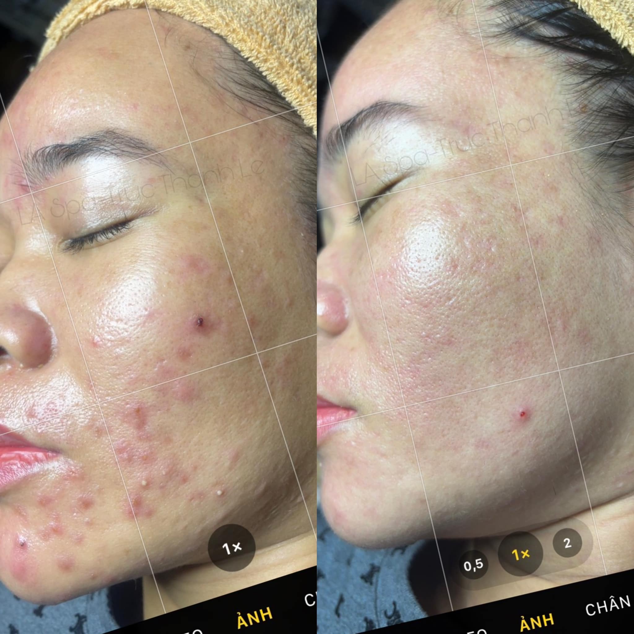 La Spa & Skincare ảnh 1