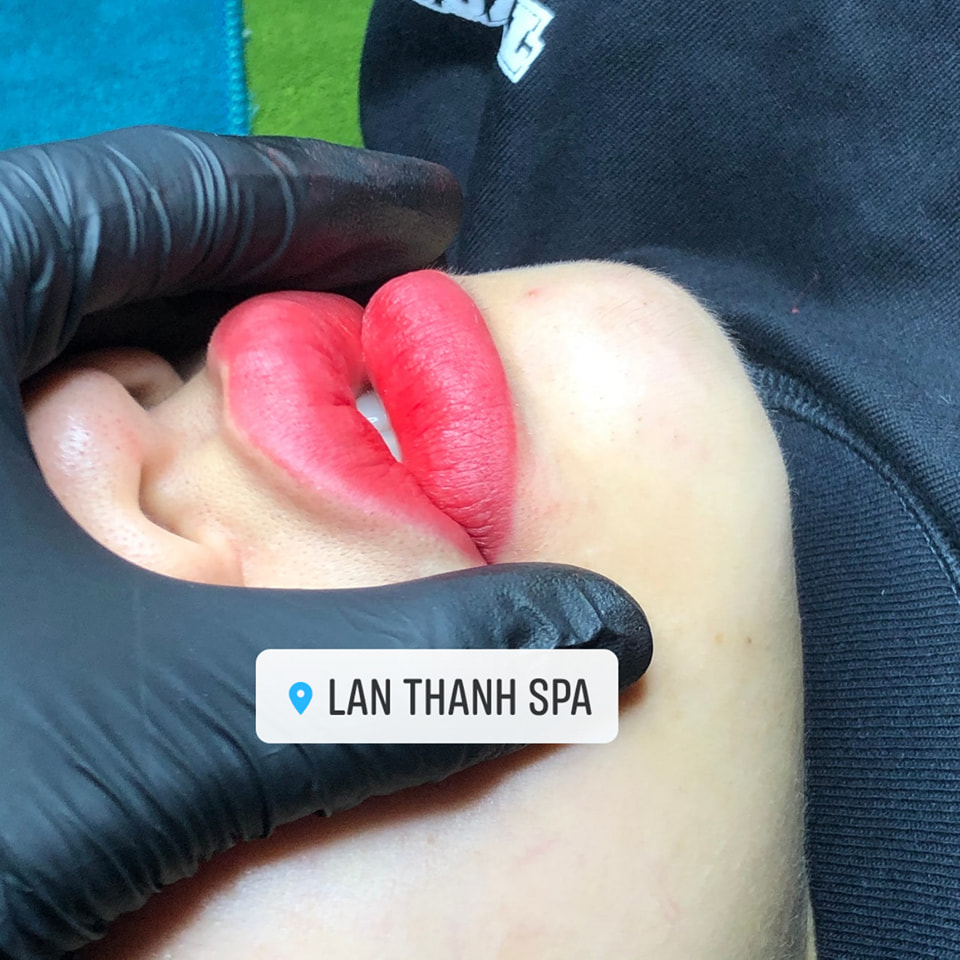 Lan Thanh Spa ảnh 2